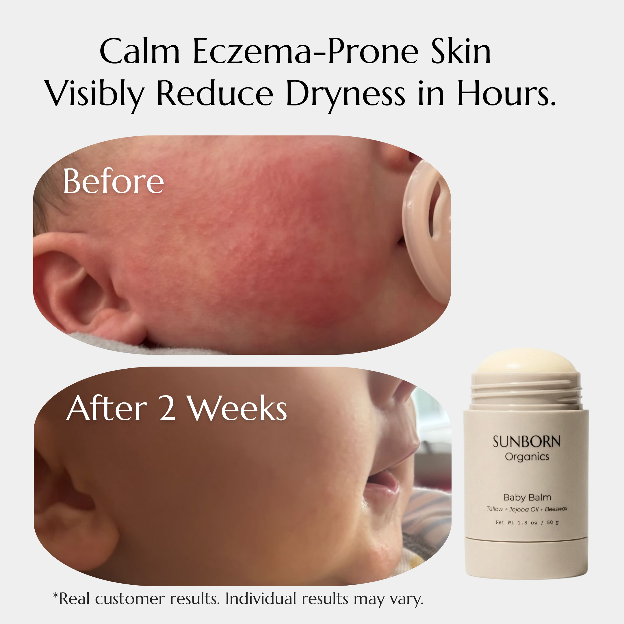 Baby Balm