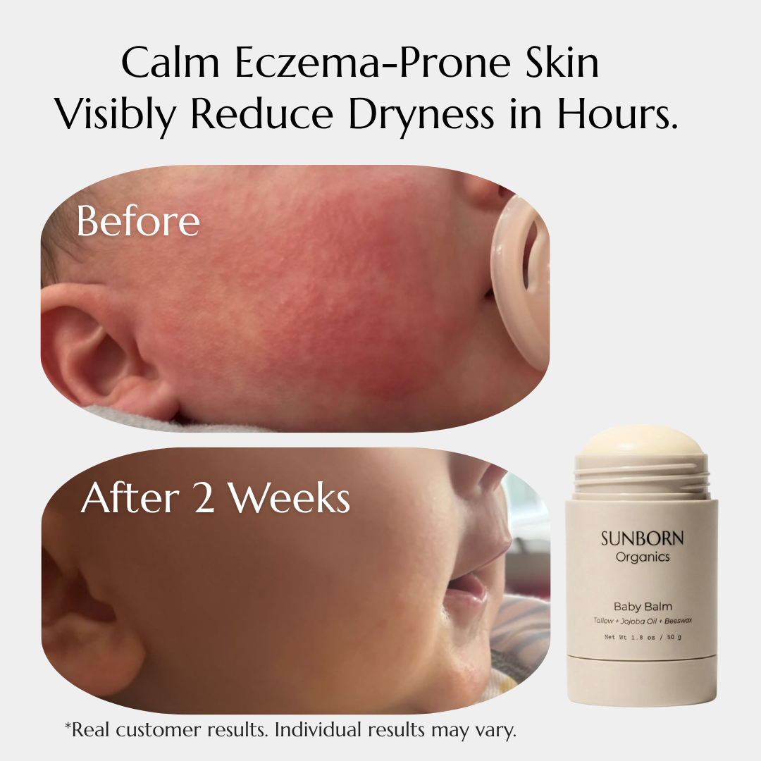 Baby Balm